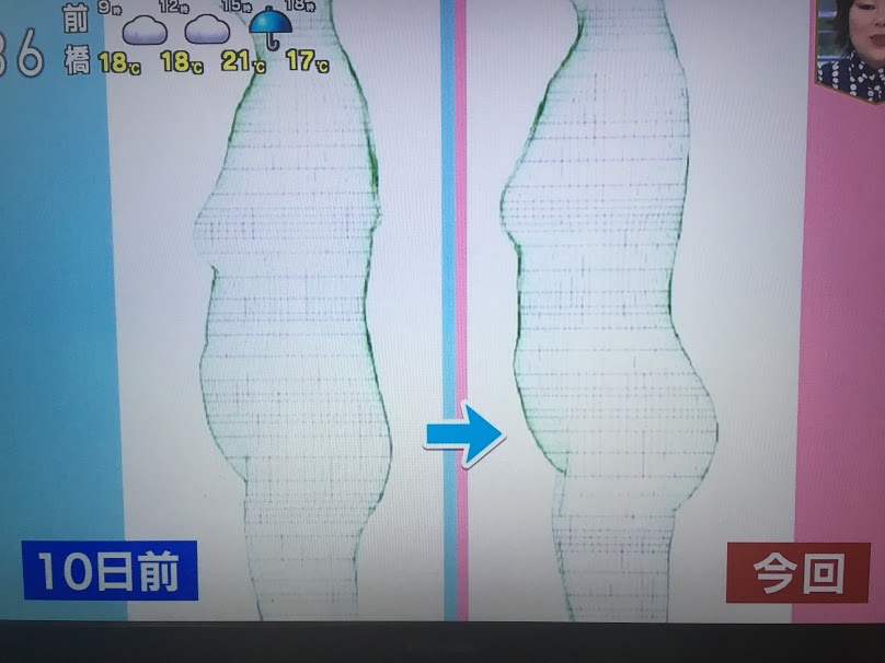 お尻ペンはさみエクササイズの結果