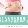 【NHKあさイチまとめ】あなたも隠れ脂肪肝！？40代以降の女性は特に注意！（6月3日）